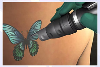 Med Spa Lexington KY | Botox | Hair Removal | Tattoo Removal | Acne