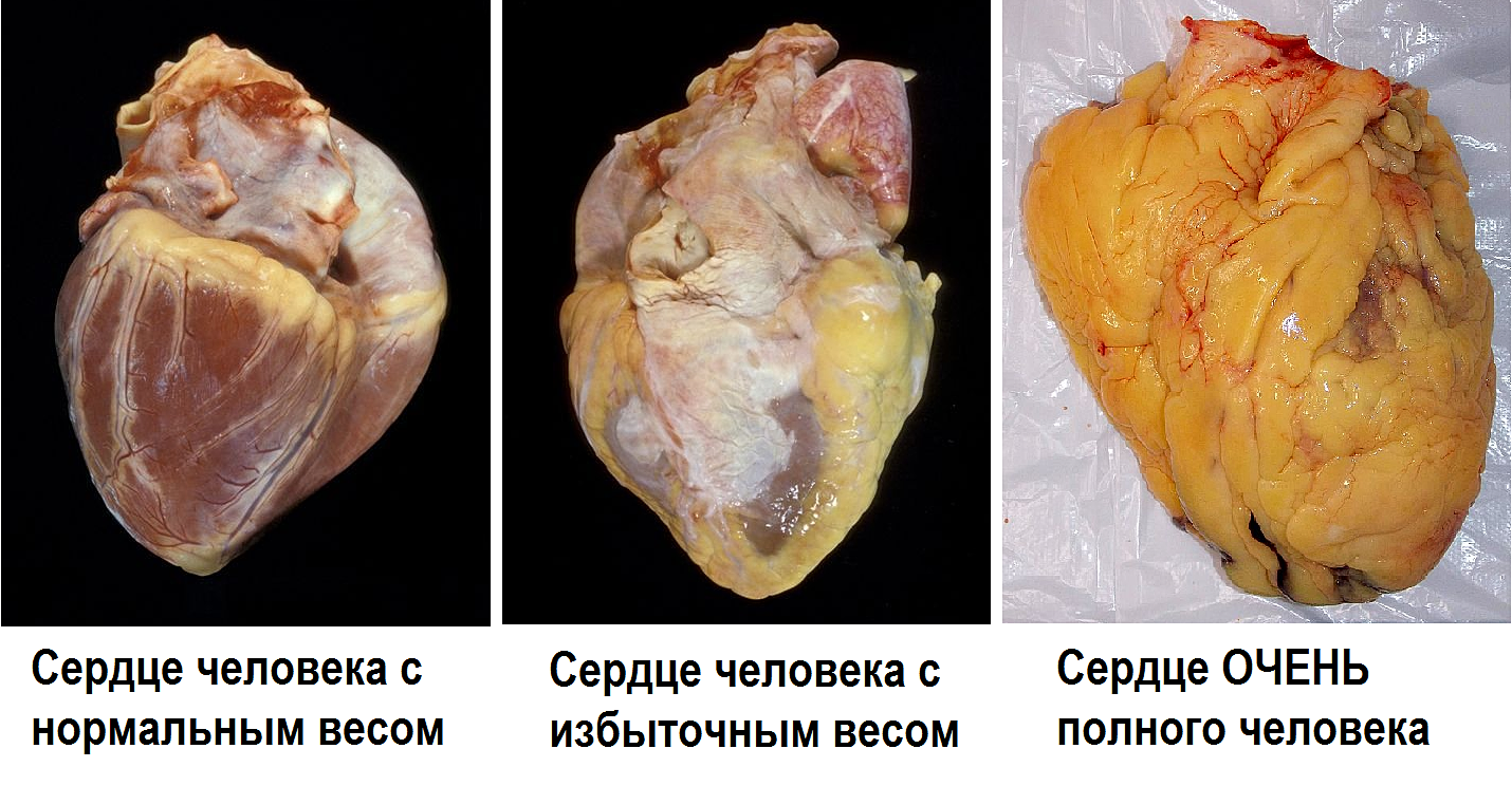 похудеть за 1.5 месяца похудеть за 1.5 месяца