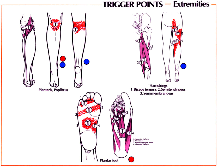 Most Effective Sciatica Home Treatments | sciaticapaininfo