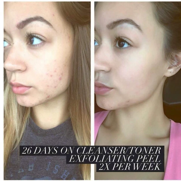 it works body wraps skincare facial wraps exfoliating peel it works skin care results