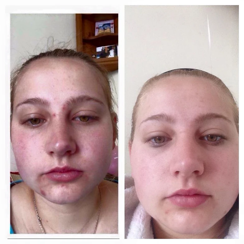 It Works Body Wraps Skincare It Works Body Wraps Skincare