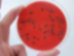 Culture microbienne