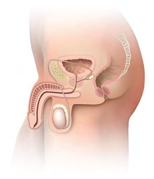 mænds g punkt blødning under samleje gravid mænds g punkt blødning under samleje gravid