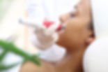 Mesotherapy, Mesotherapy microneedle, a