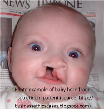 Accutane baby pictures head