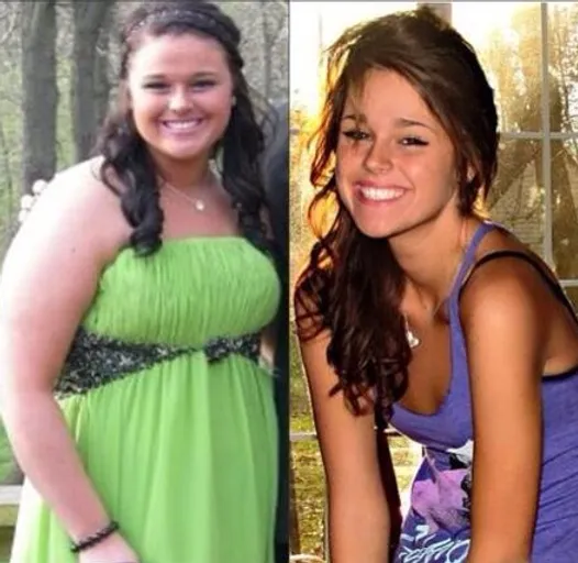 Weight loss surgery lehigh valley pa image 10