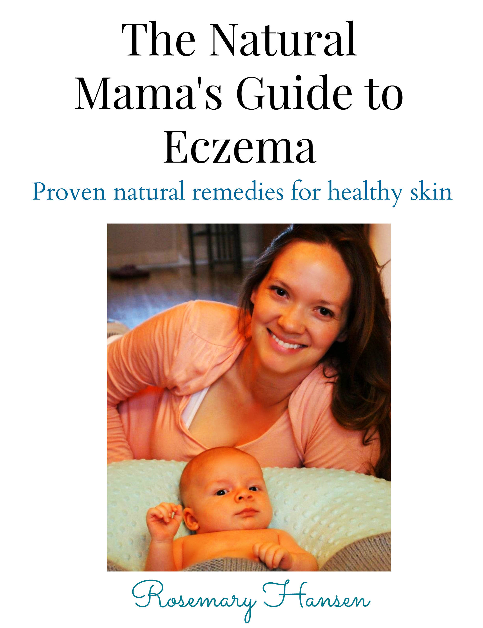 Baby Eczema Natural Treatments