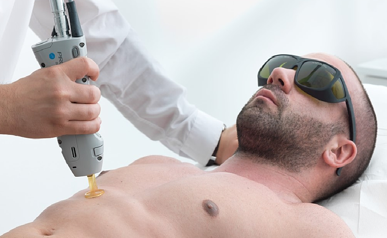 Laser Hair Removal in Mumbai