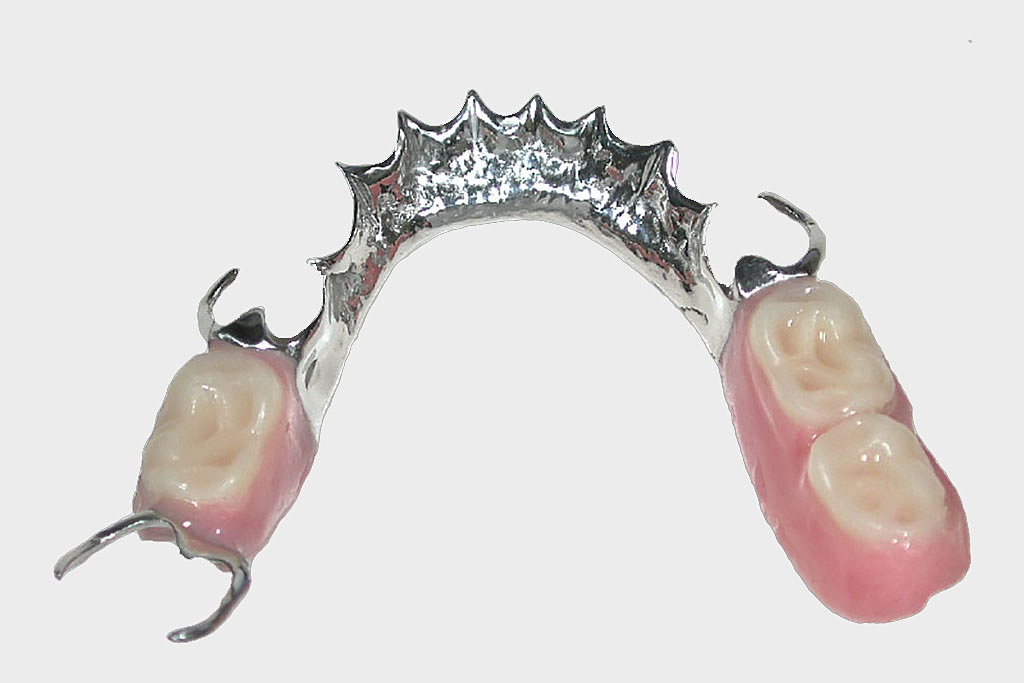 Allstar Dental Laboratories Ltd. Apron Bar