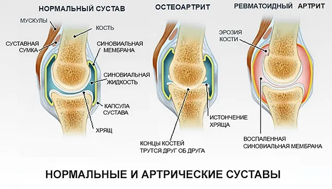 Новые технологии в оздоровлении суставов где можно сделать артроскопическую операцию коленного сустава в г пятигорске