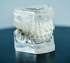 brackets.jpeg