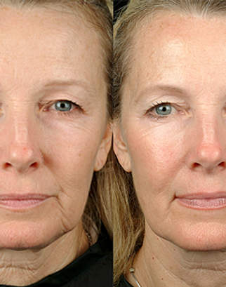 Dr. Monlezun: Lake Charles, LA: Skin Care, Hair Removal, Wrinkle