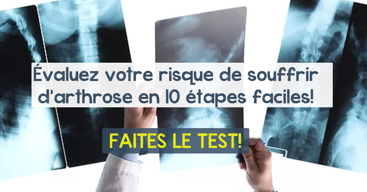 Évaluez votre risque de souffrir d’arthrose en 10 étapes Évaluez votre risque de souffrir d’arthrose en 10 étapes