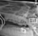 digital radiography