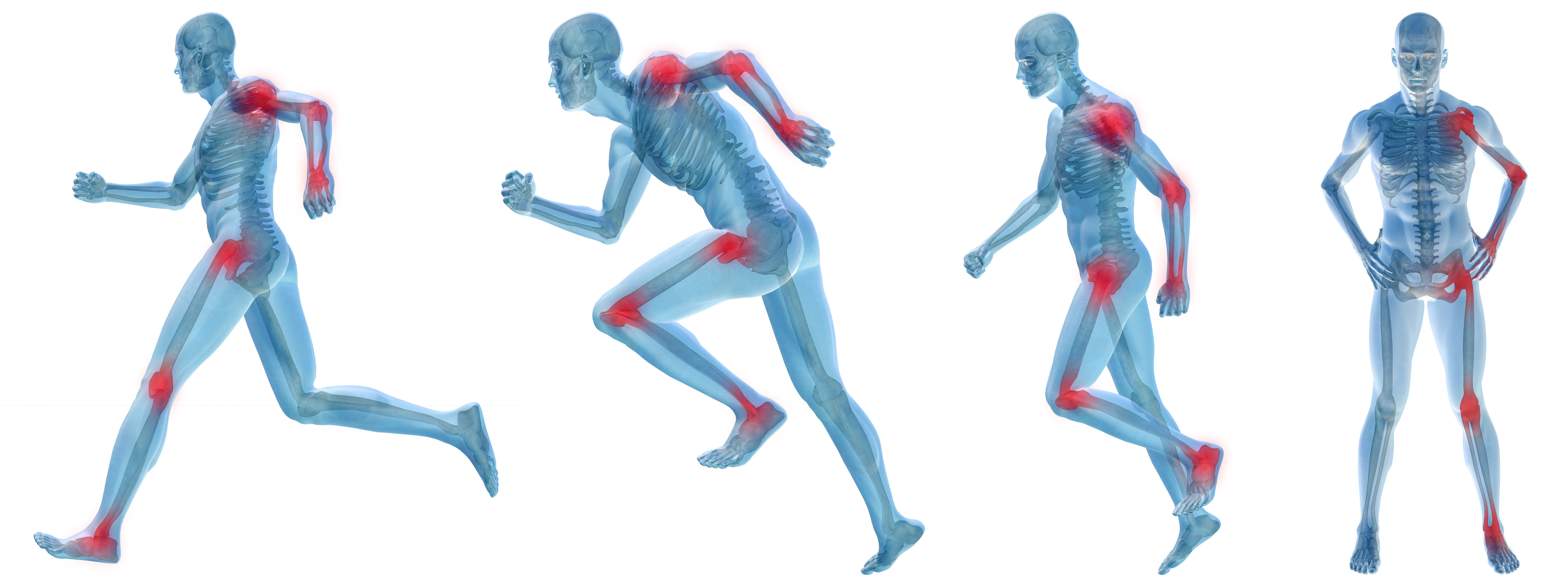 The Gavilán, IASTM, Instruments, Physical Therapy, Técnica Gavilán