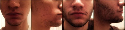 VitaBeard отзывы