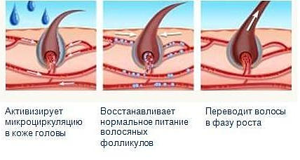 миноксидил для бороды