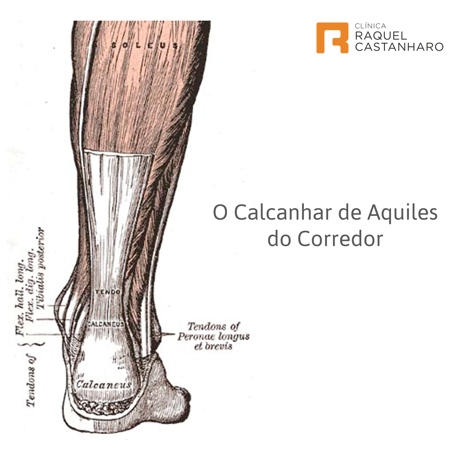 O Calcanhar de Aquiles do corredor | Biomecânica da Corrida ...