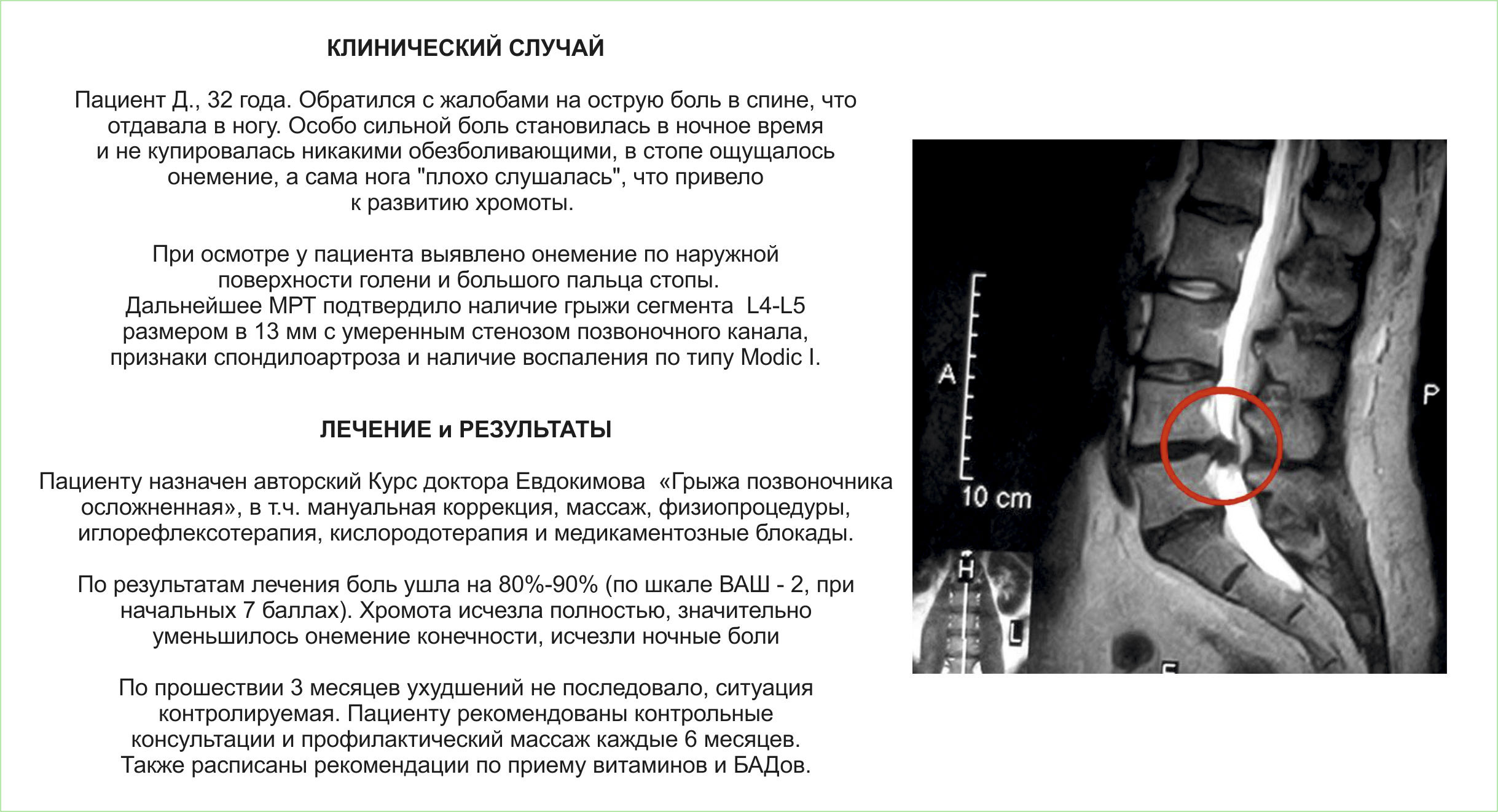 После Операция Позвоночника Когда Можно Заниматься Сексом