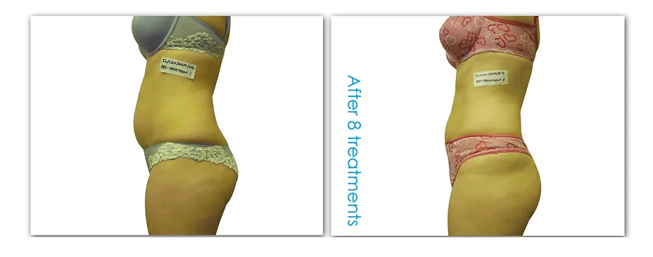 Lose fat on face and neck image 2