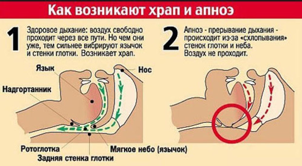 Насадки для носа от храпа