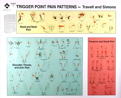trigger points myofascial trigger point charts