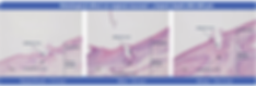 CO2 laser vaginal rejuvention Femtouch