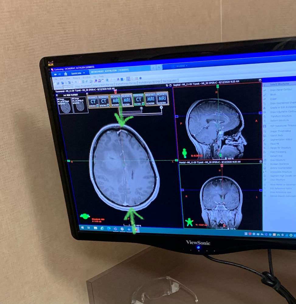 Open Vs Closed Mri Which Is Right For You Vista Health 35424 Hot Sex