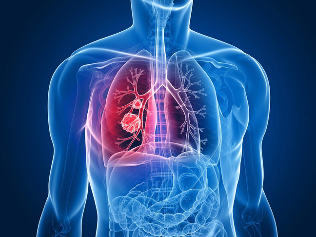 7 Primeros síntomas de cáncer que el 90% de personas ignoran 7 Primeros síntomas de cáncer que el 90% de personas ignoran