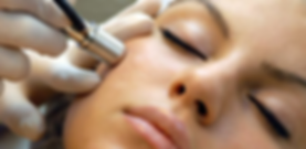 microdermabrasion-options-img.png