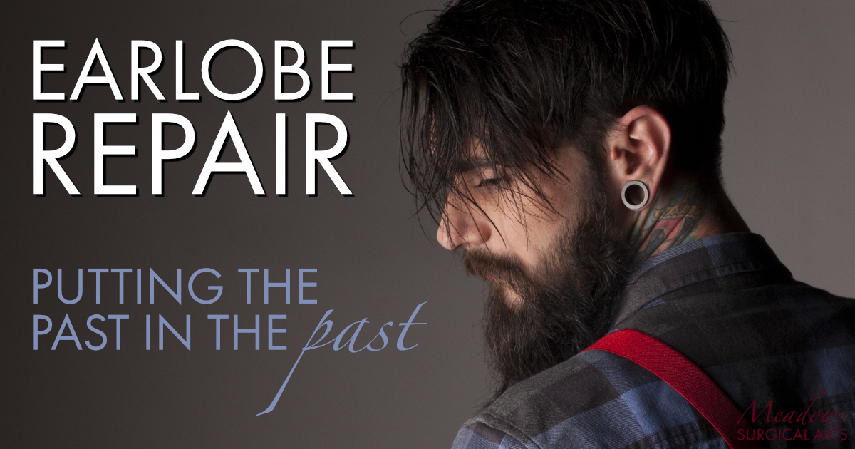 earlobe repair | meadows surgical arts