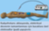Radyofrekans ablasyonda, pad adı verilen özel elektrodlar kullanılır.