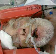 Potgieter Andre Journalist smallholding attack Bloemfontein June 13 2009.jpg