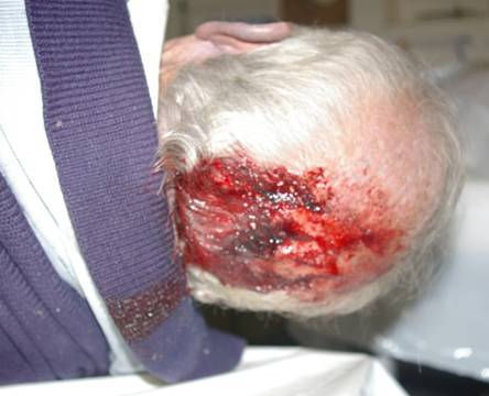 Brown James beaten to death at Kriel Police station Alzheimer sufferer SA.jpg