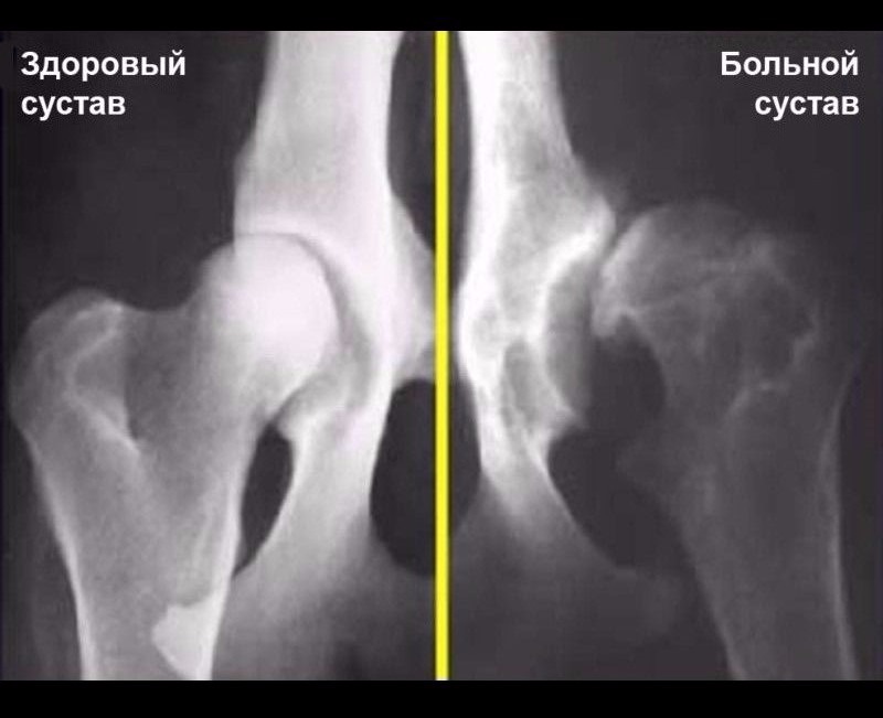 Дисплазия У Собаки Симптомы И Лечение Фото — Mixyfotos.ru