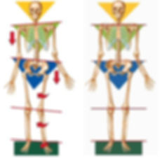 Posture, TMJ doctor in Massachusetts, Headaches, Facial pain, grinding teeth, Ramin Mehregan, Massachusetts dentist, TMJ specialist