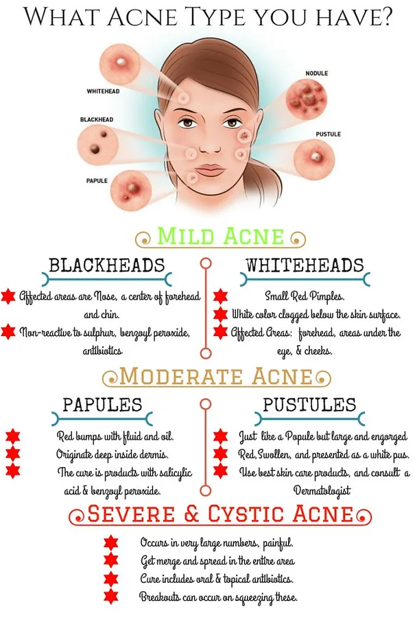 clean my face with oil the pink elephant speaks detroit blog acne chart for face