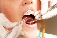 endodonzia2.jpg