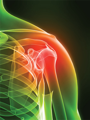 Shoulder pain