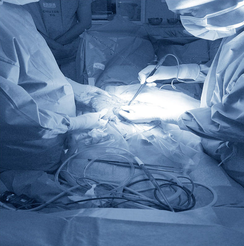 CHIRURGIE AMBULATOIRE
