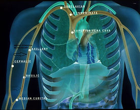 Midline-Chest-Picture-1024x809.jpg