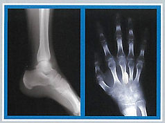 HandFoot image.jpg