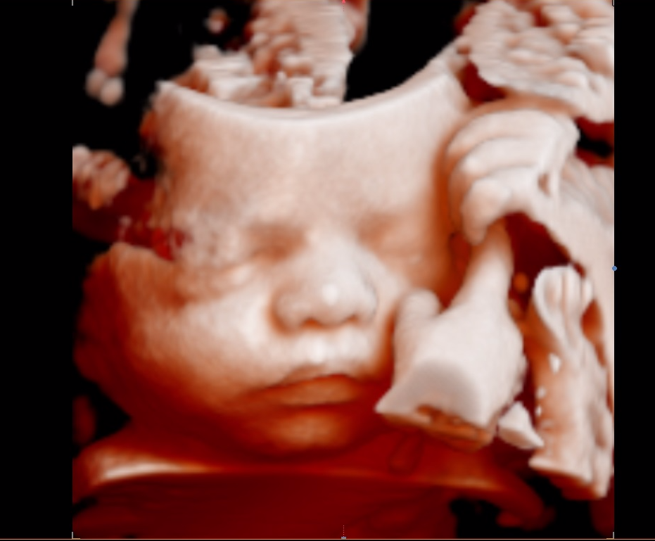 premium-early-gender-5d-4d-3d-baby-ultrasound-price-beat-guarantee