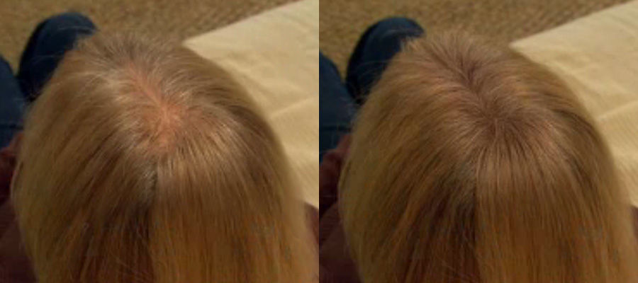 Hair Concepts For Thinning Hair And Skin And Scalp Disorders