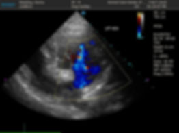echo image 4.1.jpg
