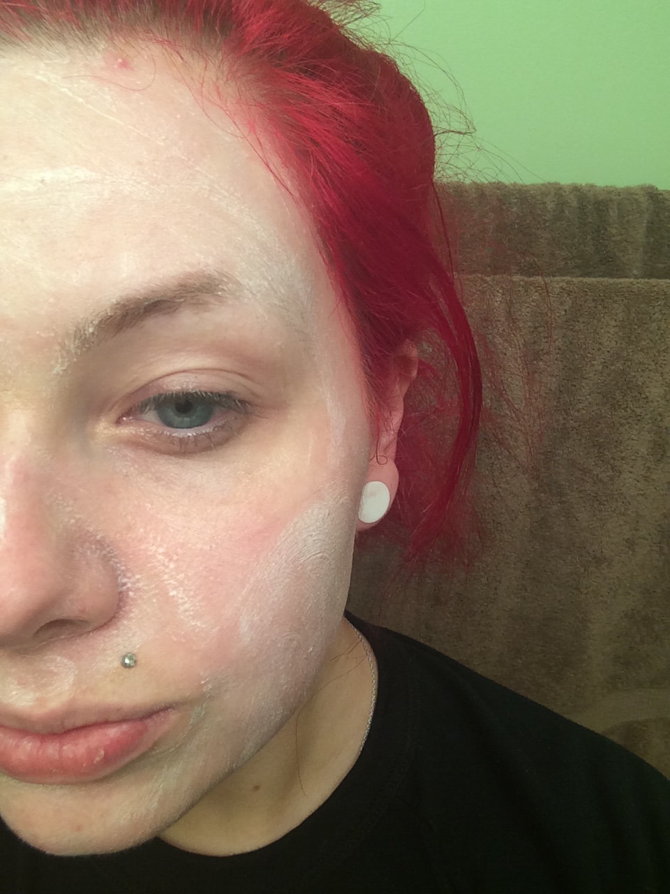 bee venom facial