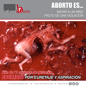 Imágenes campaña aborto