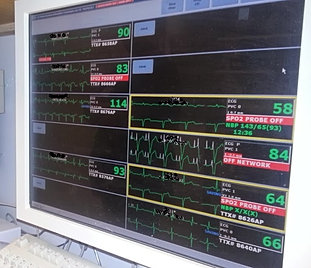 dialysis finder tucson az