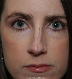 rankin-befoe-twise-nose.jpg