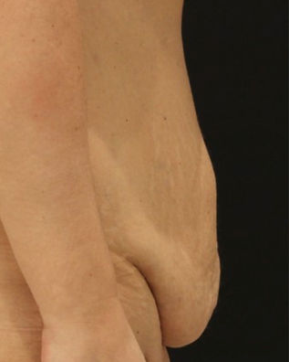 bukplastikk-case2.jpg